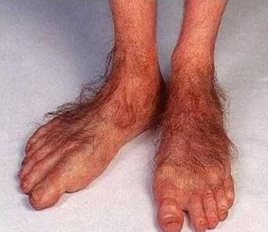 art-Embrace the fuzz